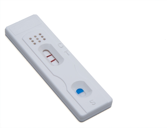 אילוסטרציה