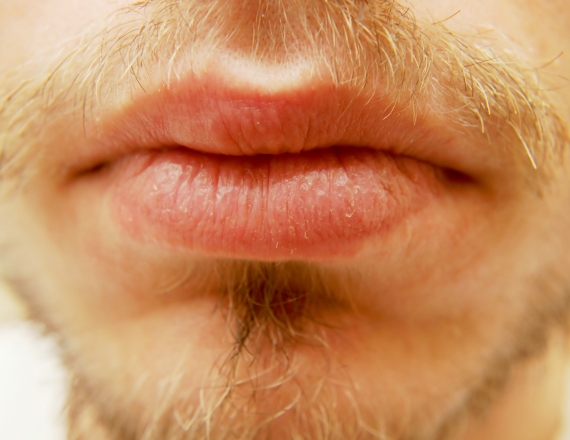 שפתיים יבשות