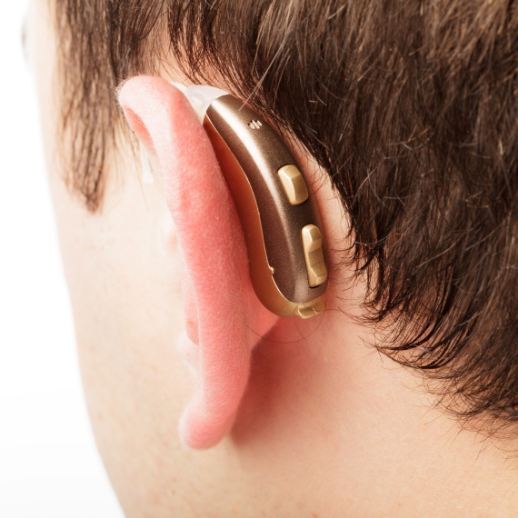 אילוסטרציה