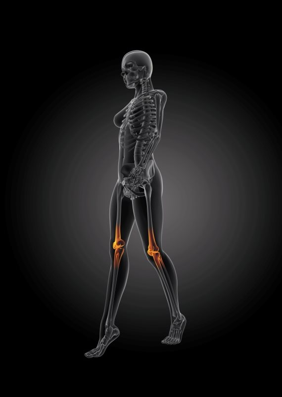 אילוסטרציה