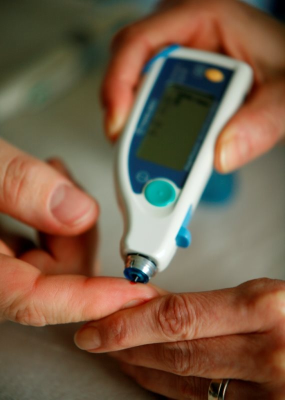 אילוסטרציה