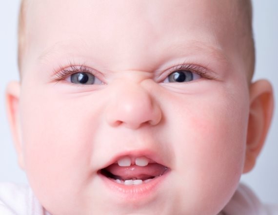 אילוסטרציה