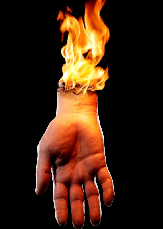 יד נשרפת