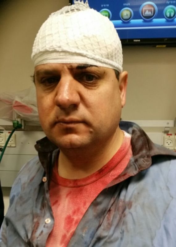 ח"כ איימן עודה