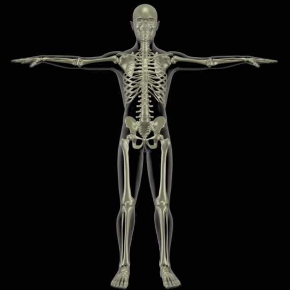 אוסטאופורוזיס