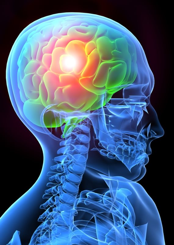 מה הסיבה לכאבי הראש?