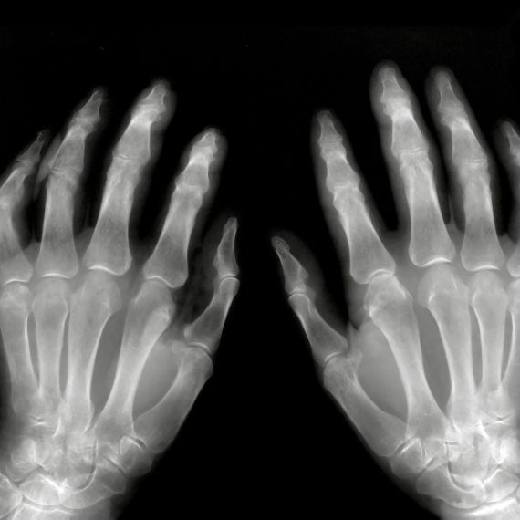 נימול באצבעות