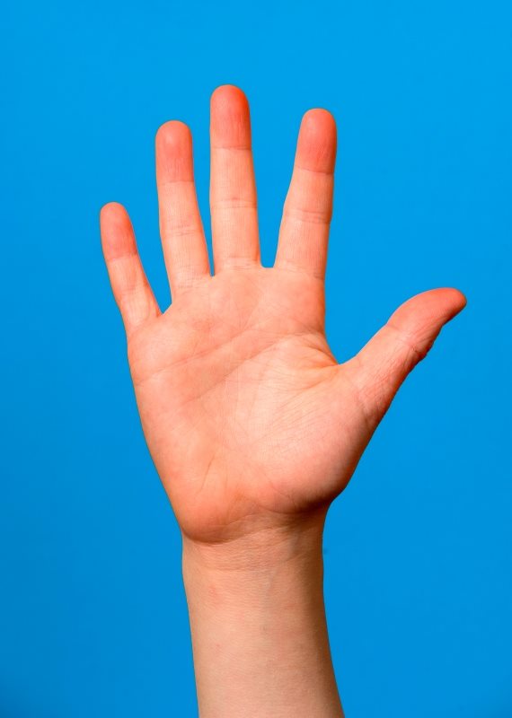 "צריך להימנע ממאכלים כתומים"