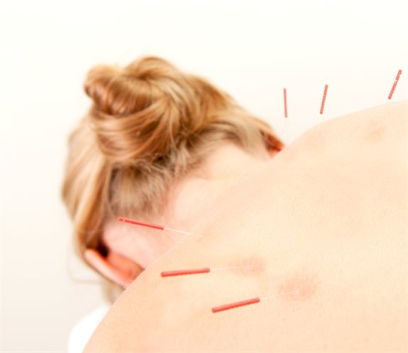 אמאל'ה, מחטים!