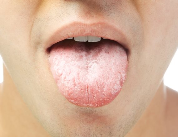 "הפנים שלי התנפחו בצורה לא רגילה"