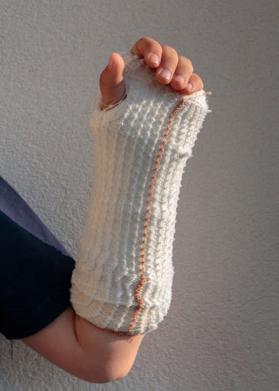 ביום שאחרי הגבס