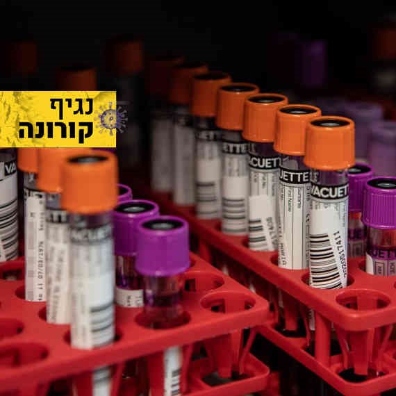 הבדיקות הסרולוגיות יוצאות לדרך