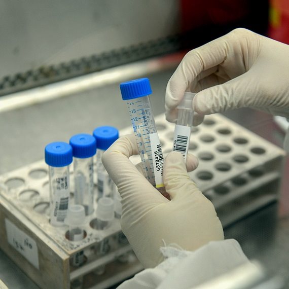 "כמו הרוב המכריע של בני האדם לא נפגעת מהווירוס"