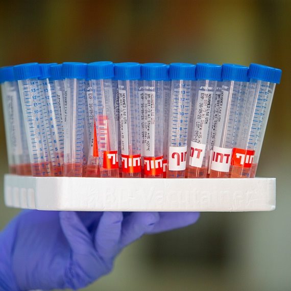 בדיקת קורונה