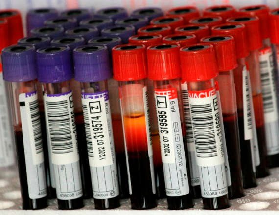 כשההמוגלובין גבוה