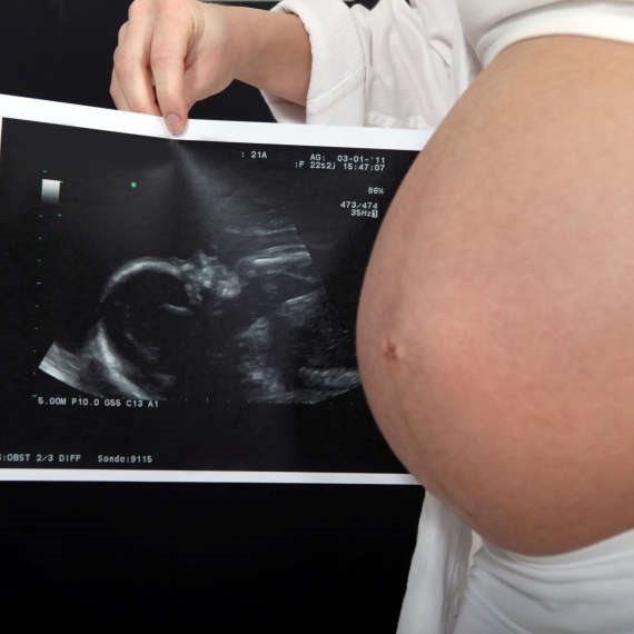 "עד כמה שאנחנו יודעים - קורונה לא מזיקה להריון"