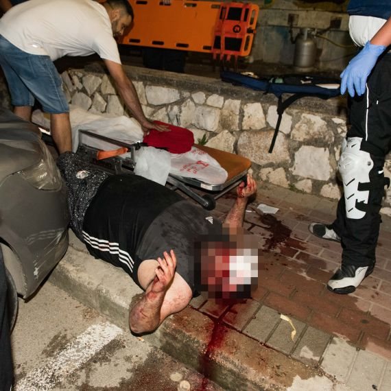 פצוע מהמהומות בעכו (ארכיון, למצולמים אין קשר לכתבה)