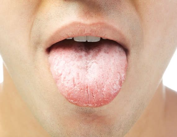 הלשון משותקת